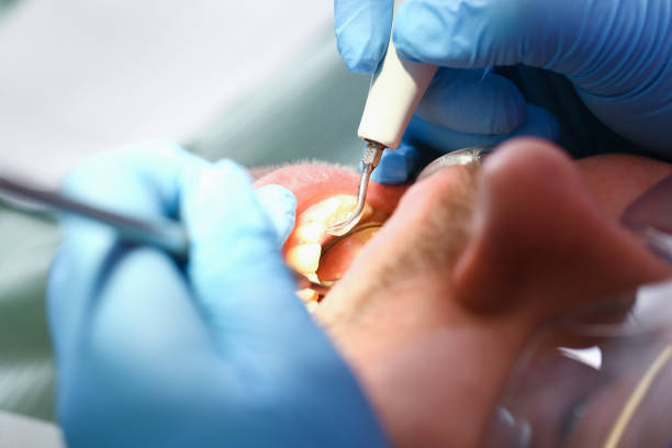 Best Weekend Emergency Dental Services in Bret Harte, CA