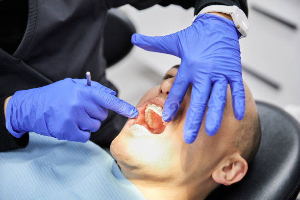 Best Urgent Dental Care for Toothaches in Bret Harte, CA